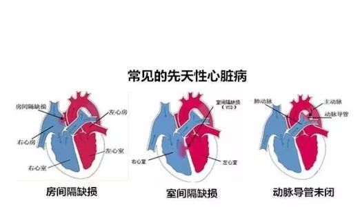 6个月胎儿心脏室间隔，发育、功能与异常解析